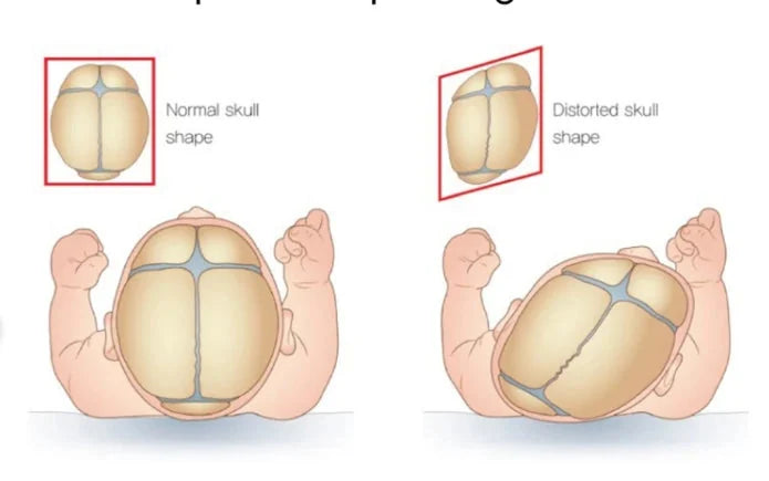 Soft Snugjooy baby head protector helping prevent infant flat head syndrome