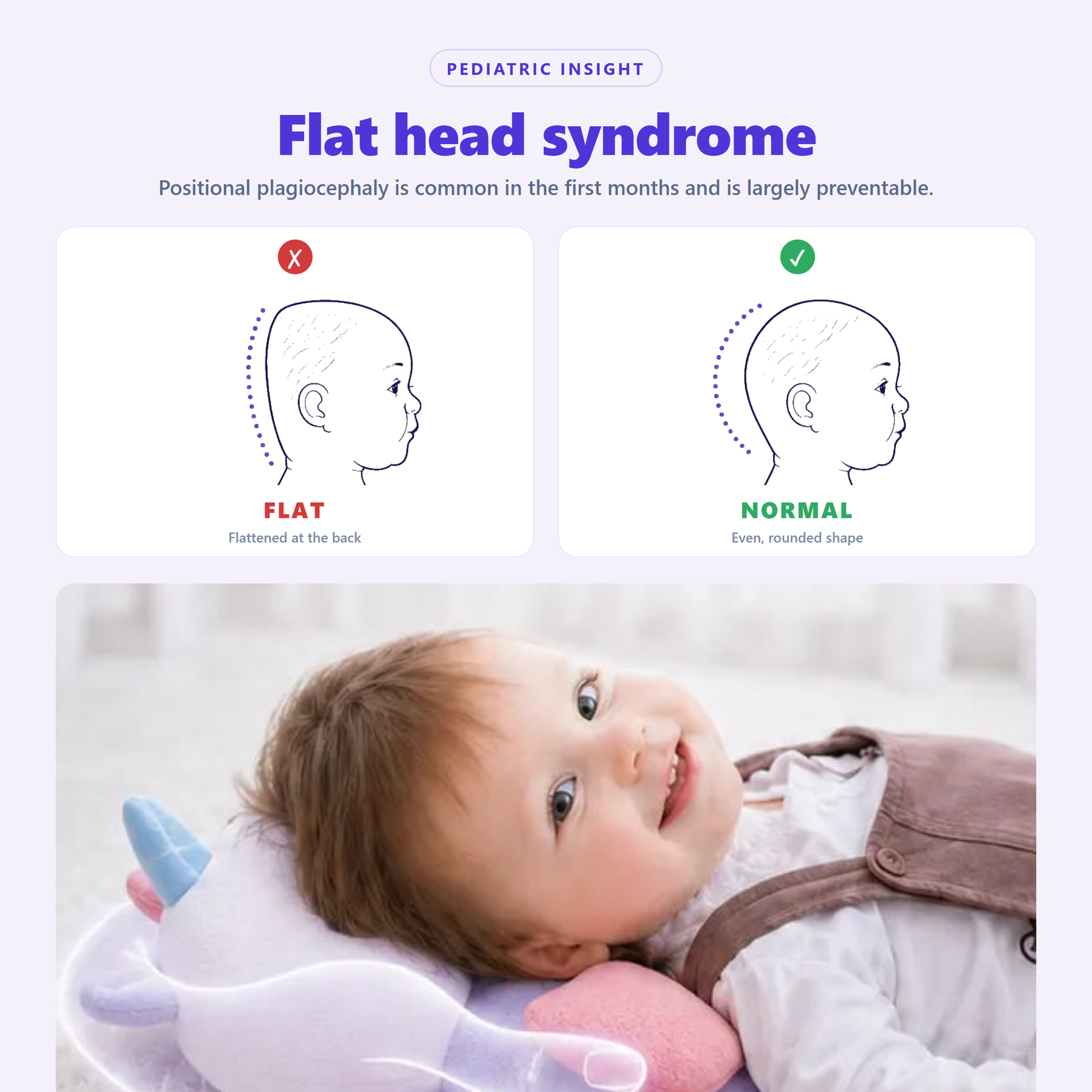 Flat head vs normal — Snugjooy keeps baby head round